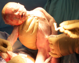 Birth Story: Annelize from Vancouver