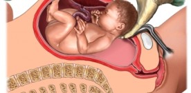 Science and C-Sections: What Do We Know?